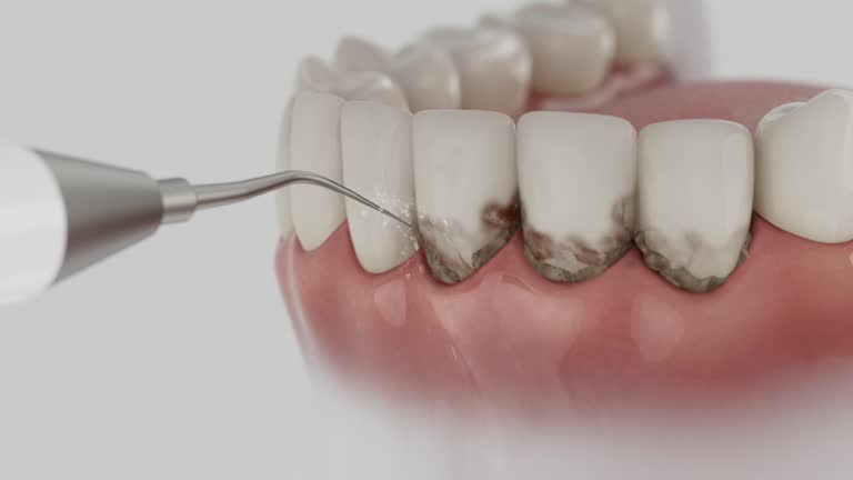 Reliable Emergency Dentist contractor in Trinity, AL by Smile Center Dentistry
